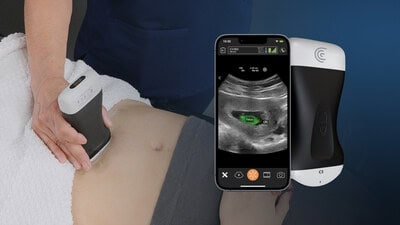 Fda Clears Clarius Ob Ai For Handheld Ultrasound: A Leap Forward In 