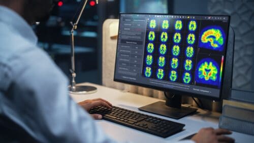 GE HealthCare Receives FDA Clearance for Alzheimer’s Imaging Tool